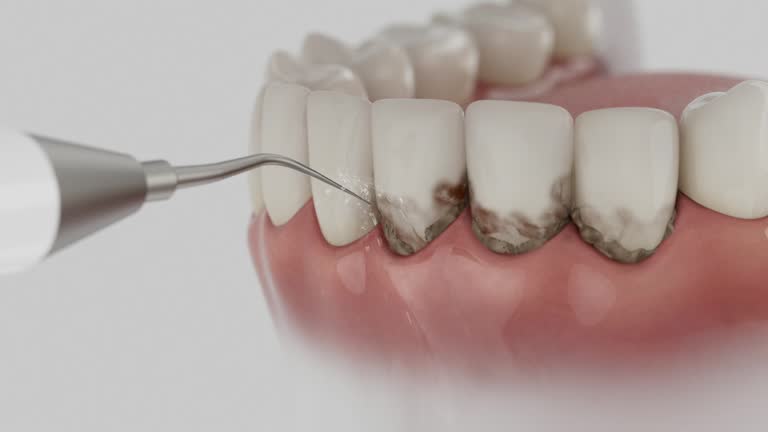 Trusted Root Canal Treatment service in Sikeston, MO - Dentist Open Now